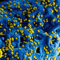 Una imagen en primer plano de un virus bajo el microscopio que recuerda al agua hidrogenada. La superficie tiene una textura de un azul vibrante, salpicada de pequeñas esferas amarillas que representan partículas virales esparcidas por la superficie azul.